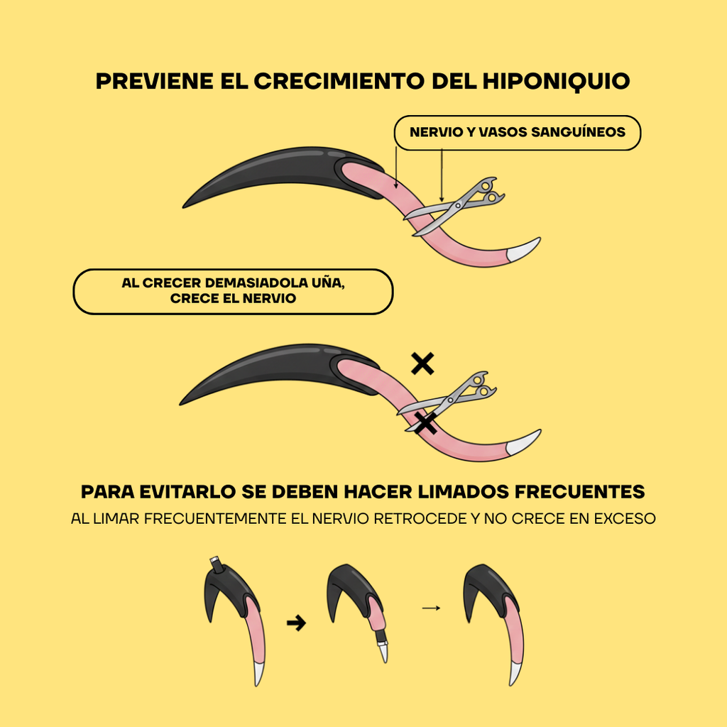Esquema del hiponiquio: el limado frecuente hace retroceder el nervio de la uña